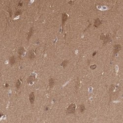 Invitrogen PDXP Polyclonal Antibody 100 &mu;L; Unconjugated:Antibodies,