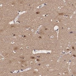 Invitrogen PDXP Polyclonal Antibody 100 &mu;L; Unconjugated:Antibodies,