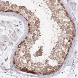 Invitrogen DNAJB7 Polyclonal Antibody 100 &mu;L; Unconjugated:Antibodies,