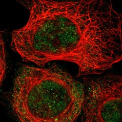 Invitrogen MAST4 Polyclonal Antibody 100 &mu;L | Buy Online | Invitrogen&trade; | Fisher Scientific