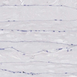 Invitrogen REPS2 Polyclonal Antibody 100 &mu;L | Buy Online | Invitrogen&trade; | Fisher Scientific