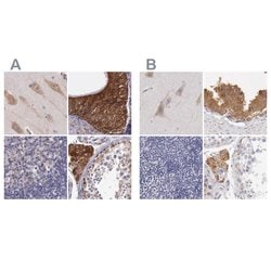 Invitrogen NSDHL Polyclonal Antibody 100 &mu;L; Unconjugated:Antibodies,