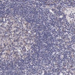Invitrogen NSDHL Polyclonal Antibody 100 &mu;L; Unconjugated:Antibodies,