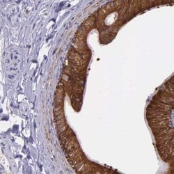 Invitrogen NSDHL Polyclonal Antibody 100 &mu;L; Unconjugated:Antibodies,