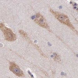 Invitrogen NSDHL Polyclonal Antibody 100 &mu;L; Unconjugated:Antibodies,