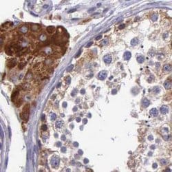Invitrogen NSDHL Polyclonal Antibody 100 &mu;L; Unconjugated:Antibodies,