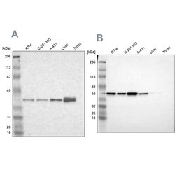 Invitrogen NSDHL Polyclonal Antibody 100 &mu;L; Unconjugated:Antibodies,