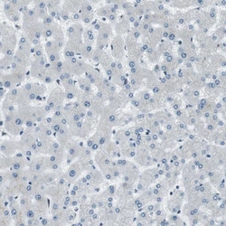Invitrogen PJA Polyclonal Antibody 100 &mu;L | Buy Online | Invitrogen&trade; | Fisher Scientific