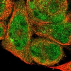 Invitrogen DHRS1 Polyclonal Antibody 100 &mu;L; Unconjugated:Antibodies,