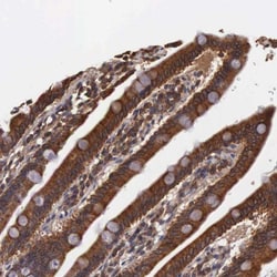 Invitrogen DHRS1 Polyclonal Antibody 100 &mu;L; Unconjugated:Antibodies,