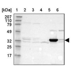 Invitrogen DHRS1 Polyclonal Antibody 100 &mu;L | Buy Online | Invitrogen&trade; | Fisher Scientific
