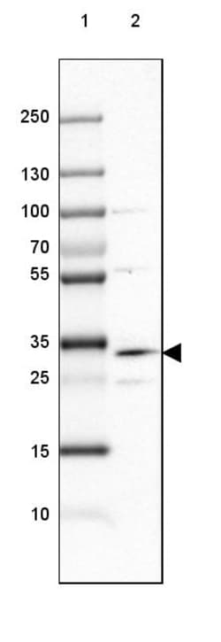 Invitrogen DHRS1 Polyclonal Antibody 100 &mu;L | Buy Online | Invitrogen&trade; | Fisher Scientific