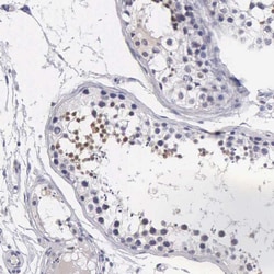 Invitrogen FAM47A Polyclonal Antibody 100 &mu;L; Unconjugated:Antibodies,