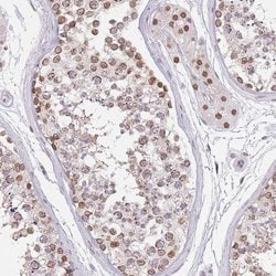 Invitrogen KLHDC2 Polyclonal Antibody 100 &mu;L; Unconjugated:Antibodies,