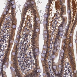 Invitrogen IGBP1 Polyclonal Antibody 100 &mu;L; Unconjugated:Antibodies,