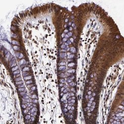 Invitrogen IGBP1 Polyclonal Antibody 100 &mu;L; Unconjugated:Antibodies,