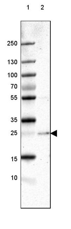 Invitrogen PABPN1 Polyclonal Antibody 100 &mu;L; Unconjugated:Antibodies,