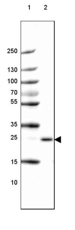 Invitrogen PABPN1 Polyclonal Antibody 100 &mu;L; Unconjugated:Antibodies,