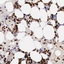 Invitrogen FCN1 Polyclonal Antibody 100 &mu;L | Buy Online | Invitrogen&trade; | Fisher Scientific