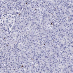 Invitrogen FCN1 Polyclonal Antibody 100 &mu;L | Buy Online | Invitrogen&trade; | Fisher Scientific