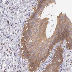 Invitrogen OSBPL3 Polyclonal Antibody 100 &mu;L; Unconjugated:Antibodies,