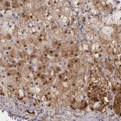 Invitrogen GSTT2B Polyclonal Antibody 100 &mu;L; Unconjugated:Antibodies,