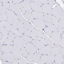 Invitrogen Serglycin Polyclonal Antibody 100 &mu;L | Buy Online | Invitrogen&trade; | Fisher Scientific