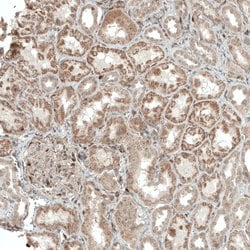 Invitrogen ACOT4 Polyclonal Antibody 100 &mu;L; Unconjugated:Antibodies,