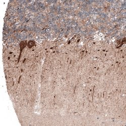 Invitrogen ACOT4 Polyclonal Antibody 100 &mu;L; Unconjugated:Antibodies,