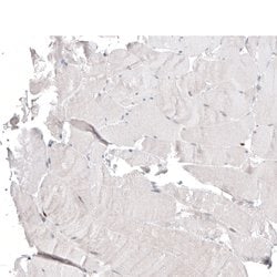 Invitrogen ACOT4 Polyclonal Antibody 100 &mu;L; Unconjugated:Antibodies,