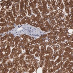Invitrogen ACOT4 Polyclonal Antibody 100 &mu;L; Unconjugated:Antibodies,