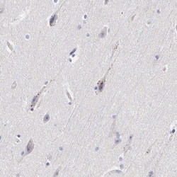 Invitrogen ELFN2 Polyclonal Antibody 100 &mu;L; Unconjugated:Antibodies,