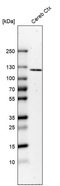 Invitrogen ELFN2 Polyclonal Antibody 100 &mu;L; Unconjugated:Antibodies,
