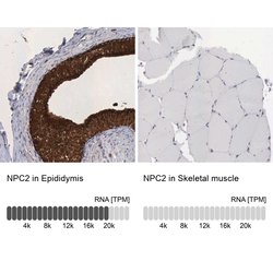 Invitrogen NPC2 Polyclonal Antibody 100 &mu;L; Unconjugated:Antibodies,