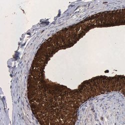 Invitrogen NPC2 Polyclonal Antibody 100 &mu;L; Unconjugated:Antibodies,
