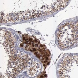 Invitrogen NPC2 Polyclonal Antibody 100 &mu;L; Unconjugated:Antibodies,