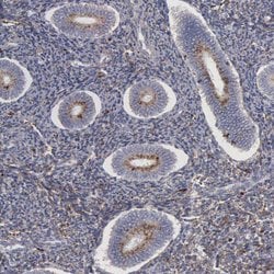 Invitrogen NPC2 Polyclonal Antibody 100 &mu;L; Unconjugated:Antibodies,