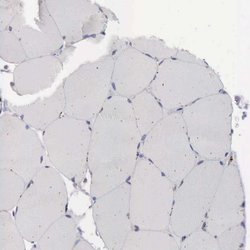 Invitrogen NPC2 Polyclonal Antibody 100 &mu;L; Unconjugated:Antibodies,
