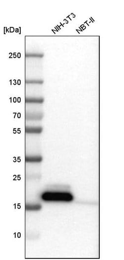 Invitrogen NPC2 Polyclonal Antibody 100 &mu;L; Unconjugated:Antibodies,