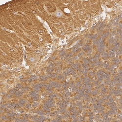 Invitrogen RALGAPA1 Polyclonal Antibody 100 &mu;L; Unconjugated:Antibodies,