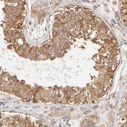 Invitrogen FKBP25 Polyclonal Antibody 100 &mu;L; Unconjugated:Antibodies,