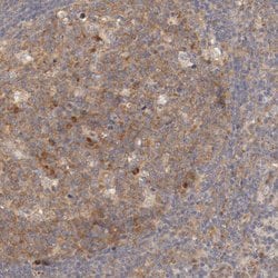 Invitrogen FKBP25 Polyclonal Antibody 100 &mu;L; Unconjugated:Antibodies,