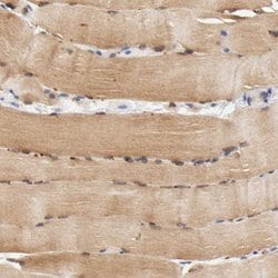 Invitrogen FKBP25 Polyclonal Antibody 100 &mu;L; Unconjugated:Antibodies,
