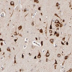 Invitrogen FKBP25 Polyclonal Antibody 100 &mu;L; Unconjugated:Antibodies,