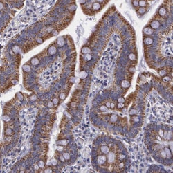 Invitrogen SYNJ2BP Polyclonal Antibody 100 &mu;L; Unconjugated:Antibodies,