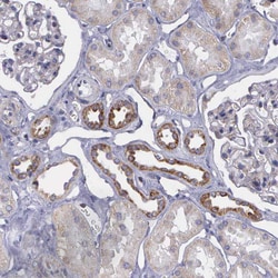 Invitrogen SYNJ2BP Polyclonal Antibody 100 &mu;L; Unconjugated:Antibodies,