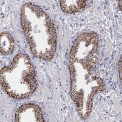 Invitrogen SYNJ2BP Polyclonal Antibody 100 &mu;L; Unconjugated:Antibodies,