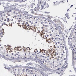 Invitrogen SYNJ2BP Polyclonal Antibody 100 &mu;L; Unconjugated:Antibodies,