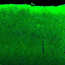 Invitrogen SYNJ2BP Polyclonal Antibody 100 &mu;L; Unconjugated:Antibodies,