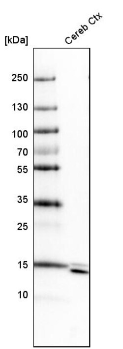 Invitrogen SYNJ2BP Polyclonal Antibody 100 &mu;L | Buy Online | Invitrogen&trade; | Fisher Scientific